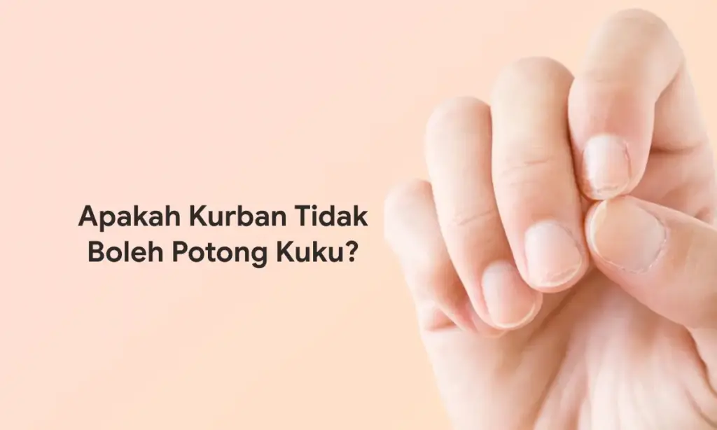 Apakah Kurban Tidak Boleh Potong Kuku