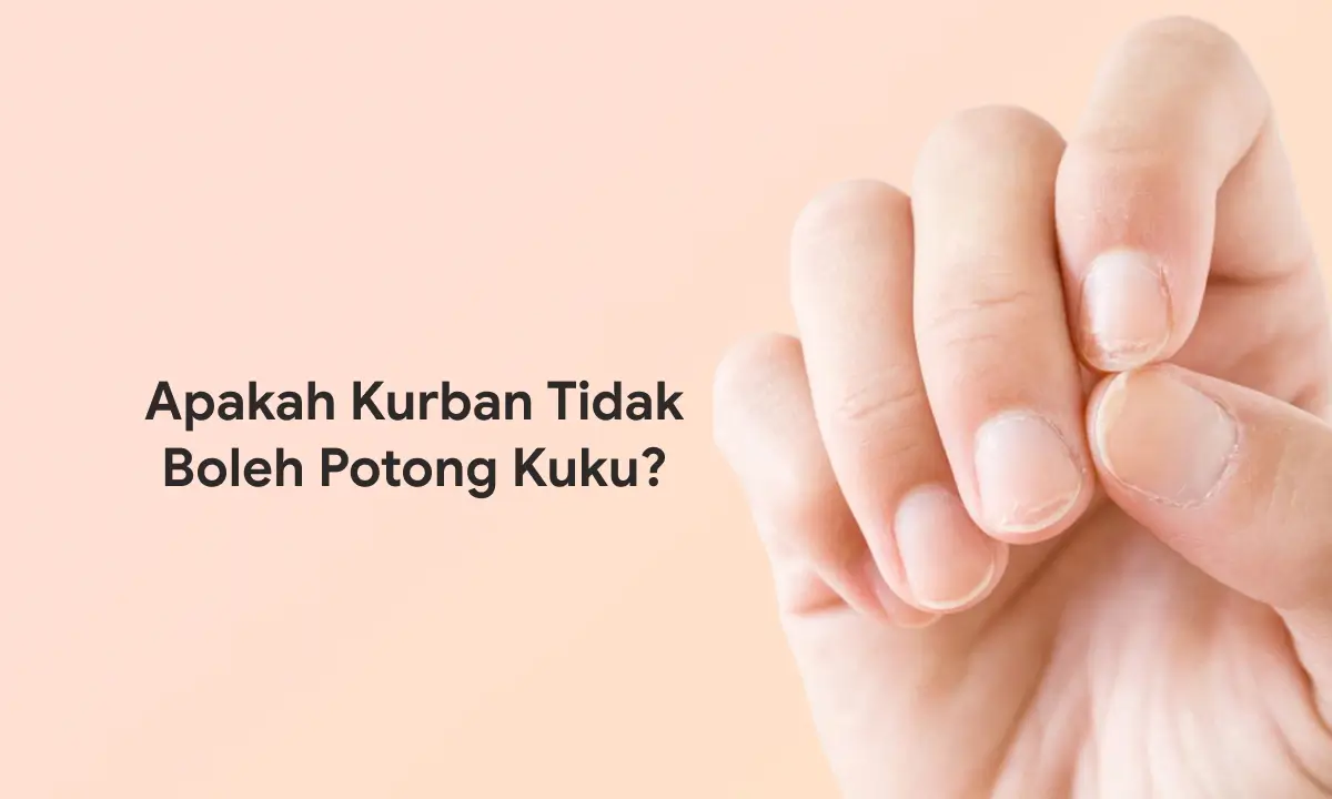 Apakah Kurban Tidak Boleh Potong Kuku